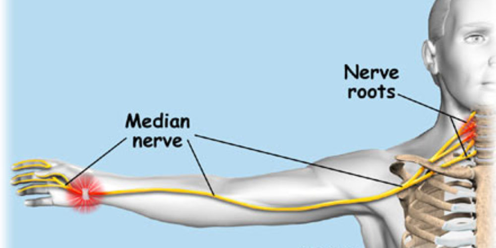 The Median Nerve - TeleEMG